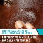 Acne Control Cleanser 237ml - Image 2